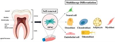 Alzheimer’s disease: Pathophysiology and dental pulp stem cells therapeutic prospects